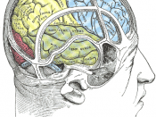 Illustration showing the position of the parietal lobe of the brain, the site of damage related to visual extinction.