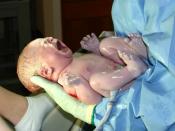 Newborn child, seconds after birth. The umbilical cord has not yet been cut.