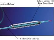 Photograph of the Taxus drug-eluting stent, from the web site of the U.S. Food and Drug Administration.