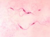 Trypanosoma forms in blood smear from patient with African trypanosomiasis. Trypanosoma forms in blood smear from patient with African trypanosomiasis. Parasite.