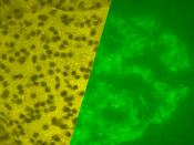 A porcine islet of Langerhans. The left image is a brightfield image created using hematoxylin stain; nuclei are dark circles and the acinar pancreatic tissue is darker than the islet tissue. The right image is the same section stained by immunofluorescen