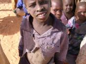 Child at a MSF camp in Chad