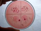 English: Transconjugant E.coli colonies grown on MacConkey's agar with sodium azide and cefotaxime.