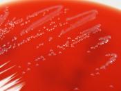 Acinetobacter ursingii on Columbia Horse Blood Agar - Detail