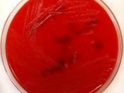 Acinetobacter ursingii on Columbia Horse Blood Agar