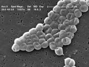 A scanning electron micrograph (SEM) of a highly magnified cluster of Gram-negative, non-motile Acinetobacter baumannii bacteria; Mag - 13331x. Source:CDC's Public Health Image Library Image #6498 Photo Credit: Janice Carr