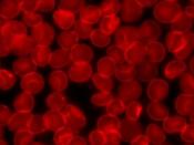 English: Human red blood cells (erythrocytes) supported on a glass slide. The cell membrane is stained with the lipid bilayer dye octadecyl rhodamine. Scale bar is 20 microns.
