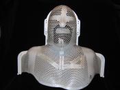 Radiation mask used in treatment of throat cancer
