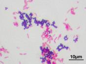 English: microscopic image of a Gram stain of mixed Gram-positive cocci (Staphylococcus aureus ATCC 25923, purple) and Gram-negative bacilli (Escherichia coli ATCC 11775, red). Magnification:1,000.