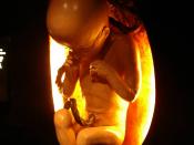 Foetus (in a natural history museum)