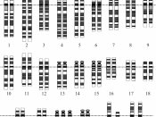 Down Syndrome Karyotype. from en: with same file name