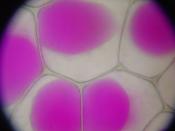 en: Epidermis cells of Rhoeo Discolor after plasmolysis. The vacuoles (pink) have shrunk. Size: Field of view ca. 450 µm de: Epidermiszellen von Rhoeo discolor nach der Plasmolyse. Die Zentralvakuolen (pink) sind stark geschrumpft. Größenangabe: Sichtfeld