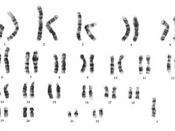 45,X karyotype, showing an unpaired X at the lower right
