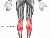 Gastrocnemius muscle
