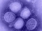 English: Novel H1N1 virus