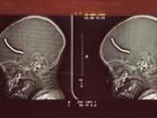 X-rays show a nail from one of Copeland's bombs embedded in a baby's brain.