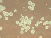 English: This photomicrograph depicts Cryptococcus neoformans using a light India ink staining preparation. Life-threatening infections caused by the encapsulated fungal pathogen Cryptococcus neoformans have been increasing steadily over the past 10 years