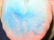 English: Tongue colored with Blue food dye revealed the fungiform papillae.