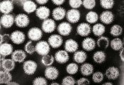 Transmission electron micrograph of multiple rotavirus particles. Each one is about 70 nanometers in meter
