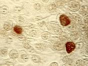 Chlamydia trachomatis inclusion bodies (brown) in a McCoy cell culture