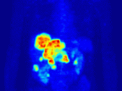 This positron emission tomography scan of a woman has a similar effect when viewed spinning