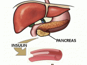 English: Diagram shows insulin release from the Pancreas and how this lowers blood sugar leves.