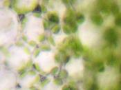 English: Palisade mesophyll cells (cross section) with chloroplasts, through the microscope Deutsch: Palisadenparenchym (Querschnitt) eines Blattes mit Chloroplasten im Lichtmikroskop