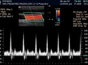 Medical spectral Doppler of common carotid artery By Daniel W. Rickey 2006