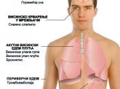 English: Symptoms of altitude disease