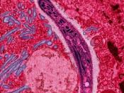 Plasmodium sporozoite traverses the cytoplasm of a mosquito midgut epithelial cell
