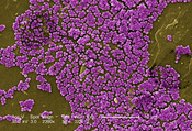 Methicillin-resistant Staphylococcus aureus 10047