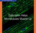 English: Cover caption: Prins et al. find that dystrophin—the protein affected in Duchenne muscular dystrophy—binds microtubules (green), which are disorganized in the muscle fibers of mice lacking dystrophin (top) compared to wild-type fibers (bottom).