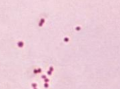 This micrograph depicts the presence of aerobic Gram-negative Neisseria meningitidis diplococcal bacteria; Mag. 1150X. Meningococcal disease is an infection caused by a bacterium called N. meningitidis or the meningococcus. The meningococcus lives in the 
