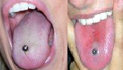 Straight barbells with either plastic or metal beads are commonly worn in tongue piercings.
