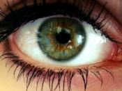 Deutsch: Zentrale Heterochromie: Grüne Iris, um die Pupille herum jedoch ein braun-gelber Ring