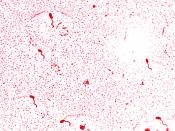 Vibrio cholerae with a Leifson flagella stain (digitally colorized)