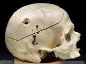 Skull showing gun shot trauma Male profile, 1950s