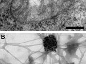 English: Electron microscopy reveals mitochondrial DNA in discrete foci. Bars: 200 nm. (A) Cytoplasmic section after immunogold labelling with anti-DNA; gold particles marking mtDNA are found near the mitochondrial membrane. (B) Whole mount view of cytopl