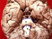 Human brain - anterior-inferior view The three divisions of the brainstem are seen here in this anterior- inferior view. Cerebrum Mesencephalon - Midbrain Pons Medulla oblongata Cerebellum (font: arial black, size: 10 and 14)