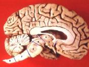 Human brain - midsagittal cut The divisions of the brain and the connection of the brain to the spinal cord is viewed here in a midsagittal cut of the brain (Half-Brain). Cerebrum Thalamus Hypothalamus Mesencephalon - Midbrain Pons Cerebellum Medulla oblo