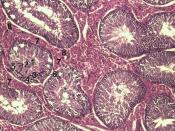 it: Sezione istologica di parenchima testicolare di cinghiale. 1 Lume del Tubulo seminifero contorto, 2 spermatidi, 3 spermatociti, 4 spermatogoni, 5 cellule del Sertoli, 6 Miofibroblasti, 7 cellule del Leydig, 8 capillari de: Histologisches Bild des Hode