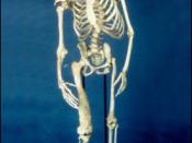 The skeleton of Joseph Merrick, the 