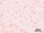 Microscopic image of Shigella flexneri. Gram staining, magnification: 1,000
