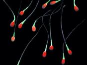 English: A false-colour image of human spermatozoa (sperm cells).