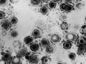 Transmission electron micrograph of herpes simplex virus Transmission electron micrograph of herpes simplex virus. Some nucleocapsids are empty, as shown by penetration of electron-dense stain.