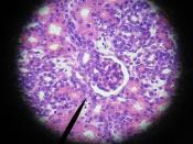 kidney - glomerulus, macula densa cells