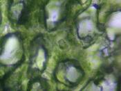 English: Spongy mesophyll layer of a leaf, through the microscope. Deutsch: Schwammparenchym eines Blattes im Lichtmikroskop