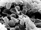 A scanning electron micrograph depicting a mass of Yersinia pestis bacteria