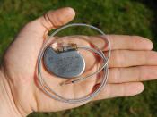 English: An artificial pacemaker from St. Jude Medical, with electrode. Français : Un Pacemaker de la compagnie St. Jude Medical, avec son électrode. Nederlands: Een kunstmatige pacemaker van St. Jude Medical, met elektrode.