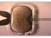 Inicío da injecção do espermatozóide no óvulo